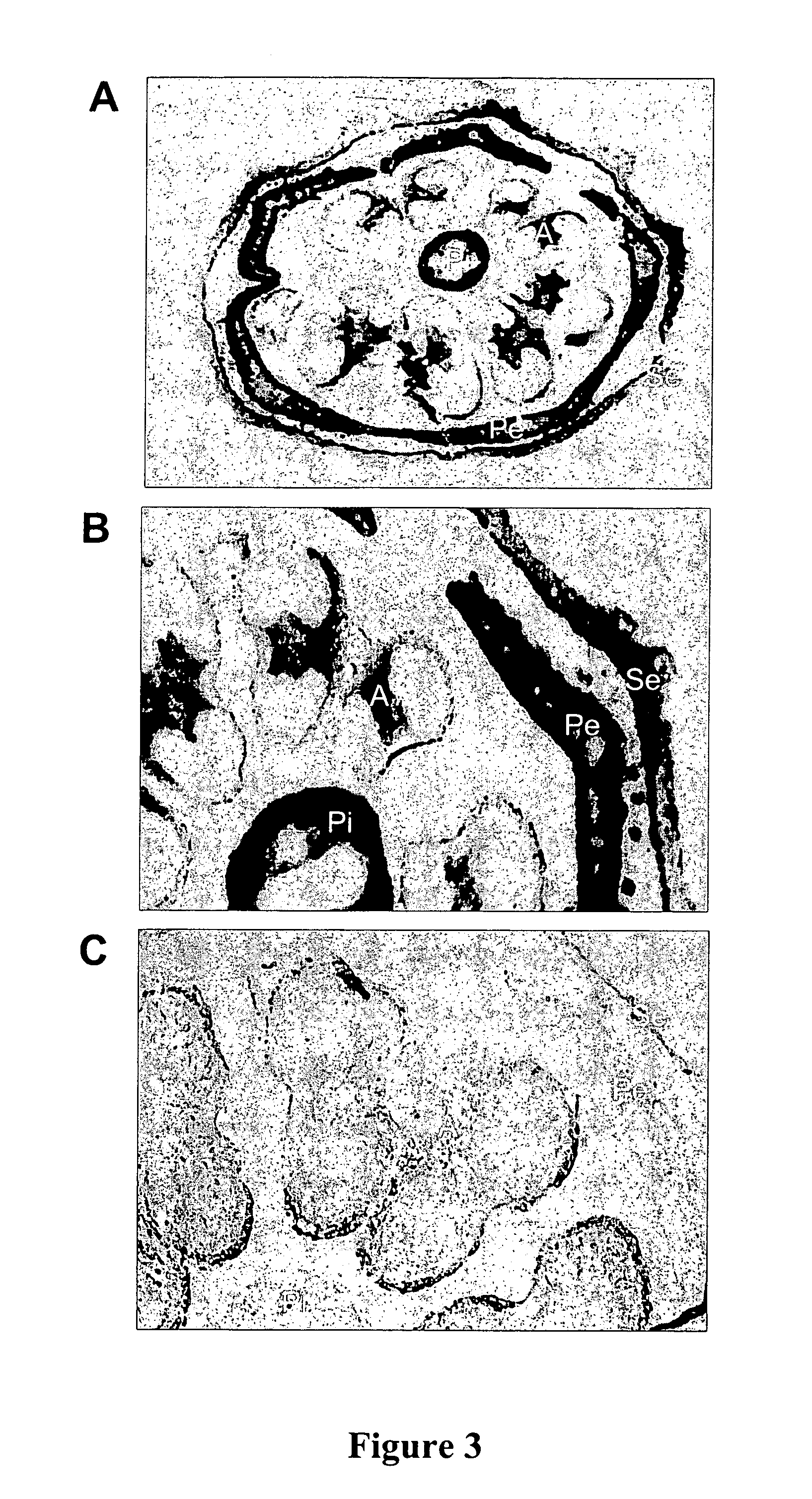 Defensin-encoding nucleic acid molecules derived from nicotiana alata, uses therfor and transgenic plants comprising same