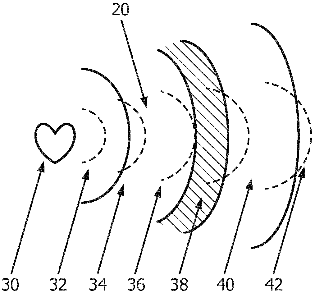 Fetal monitoring system and method