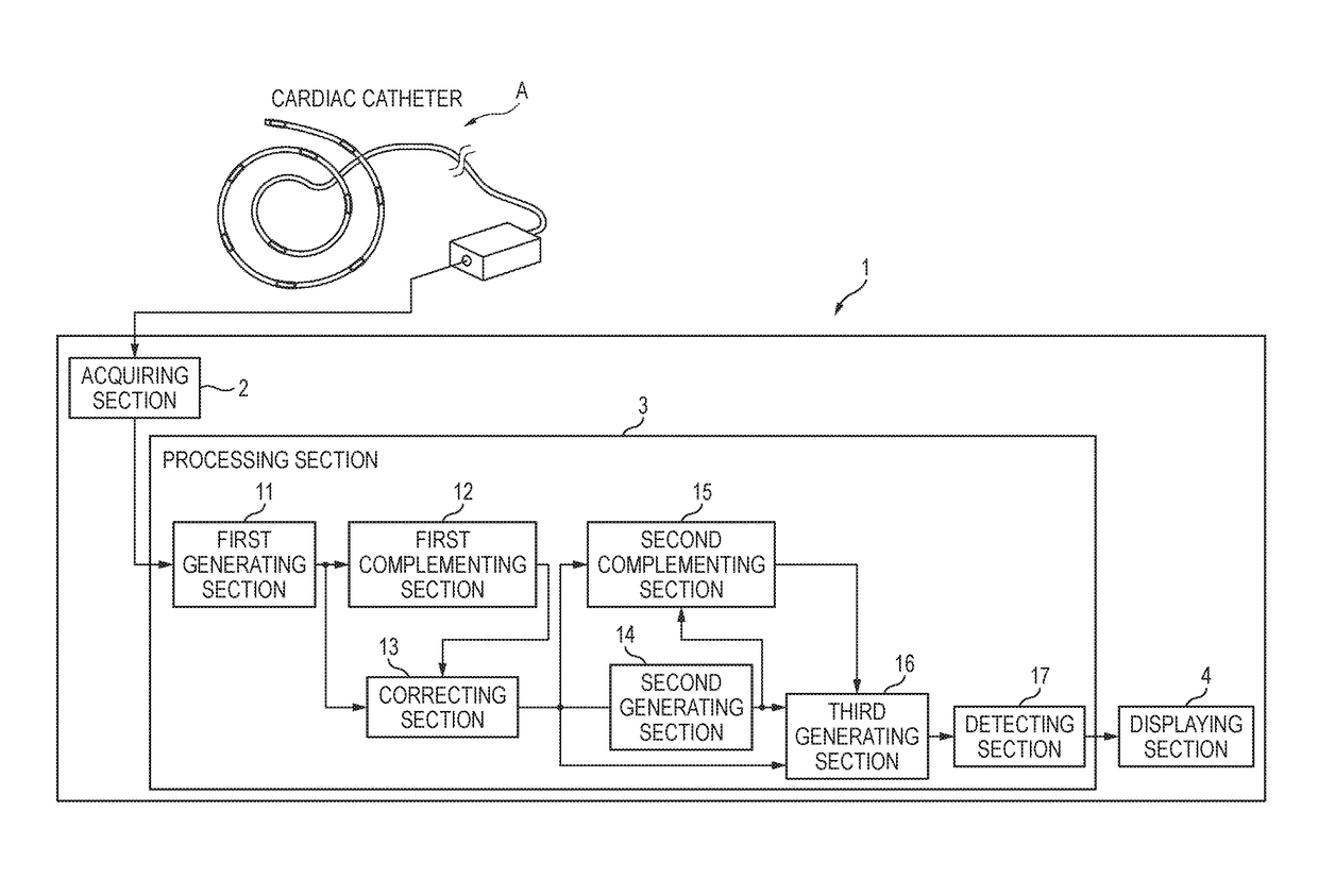 Myocardial excitation complementation/visualization apparatus and myocardial excitation detection apparatus