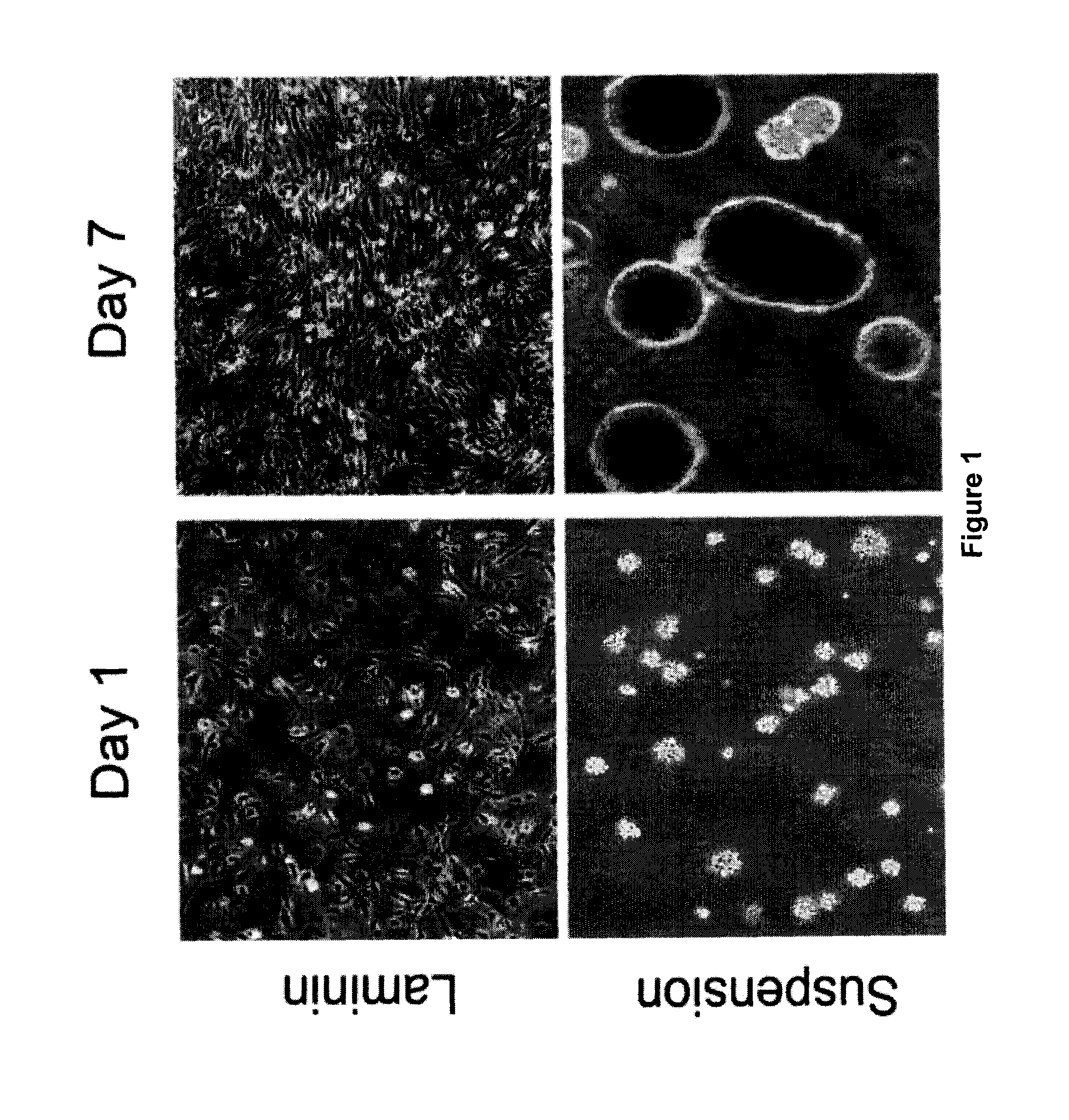 Neural tumor stem cells and methods of use thereof