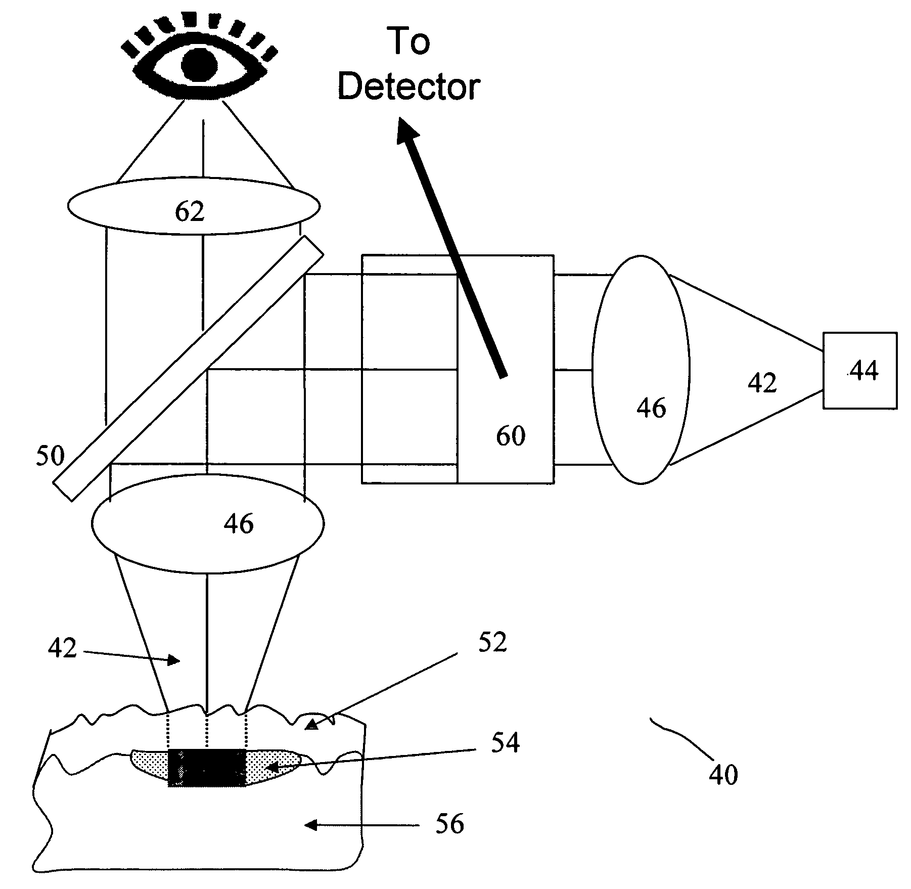 Optical in vivo analyte probe using embedded intradermal particles