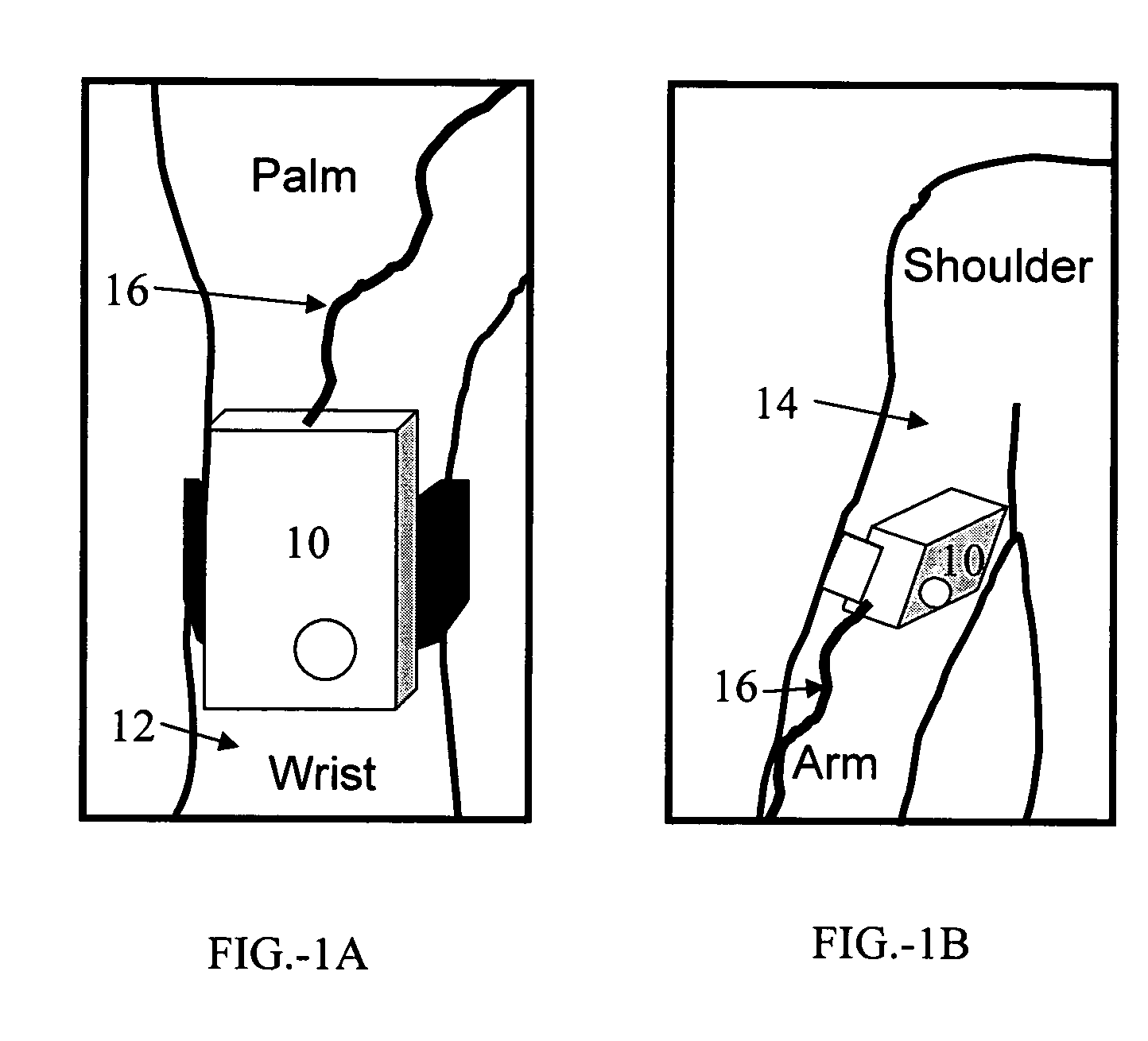 Optical in vivo analyte probe using embedded intradermal particles