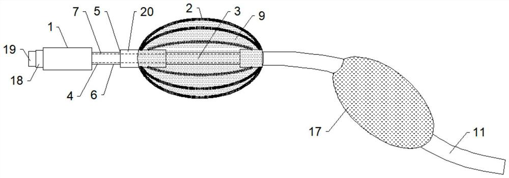 Anti-embolism carotid artery forming system