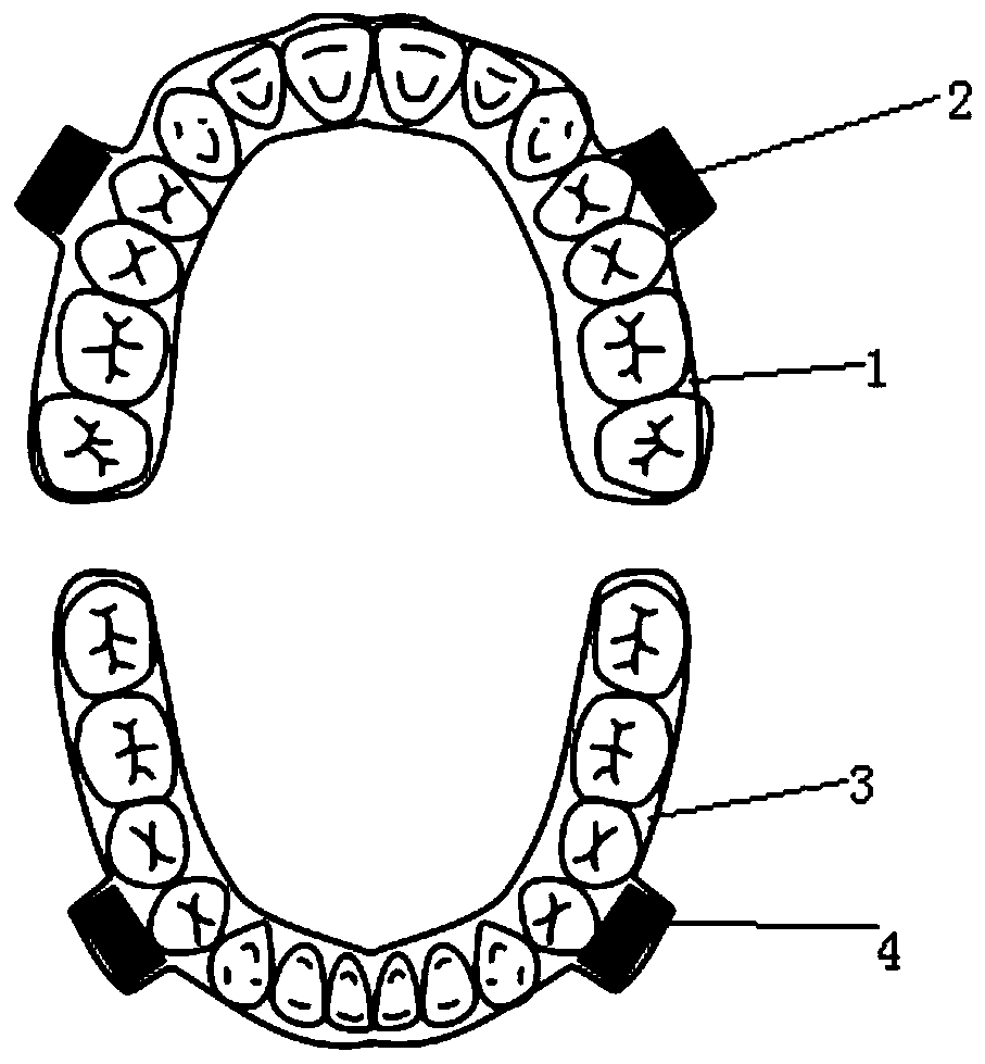 Cheek screen type invisible magnetic function appliance