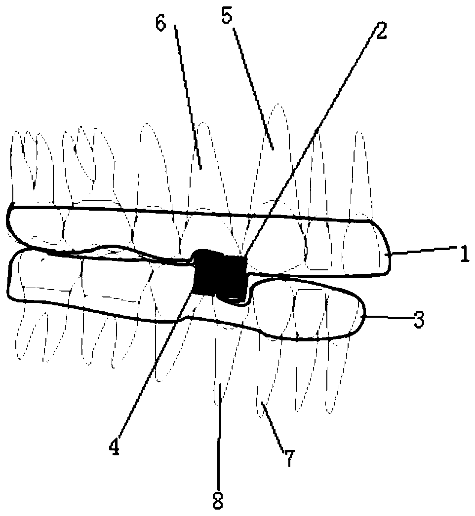 Cheek screen type invisible magnetic function appliance