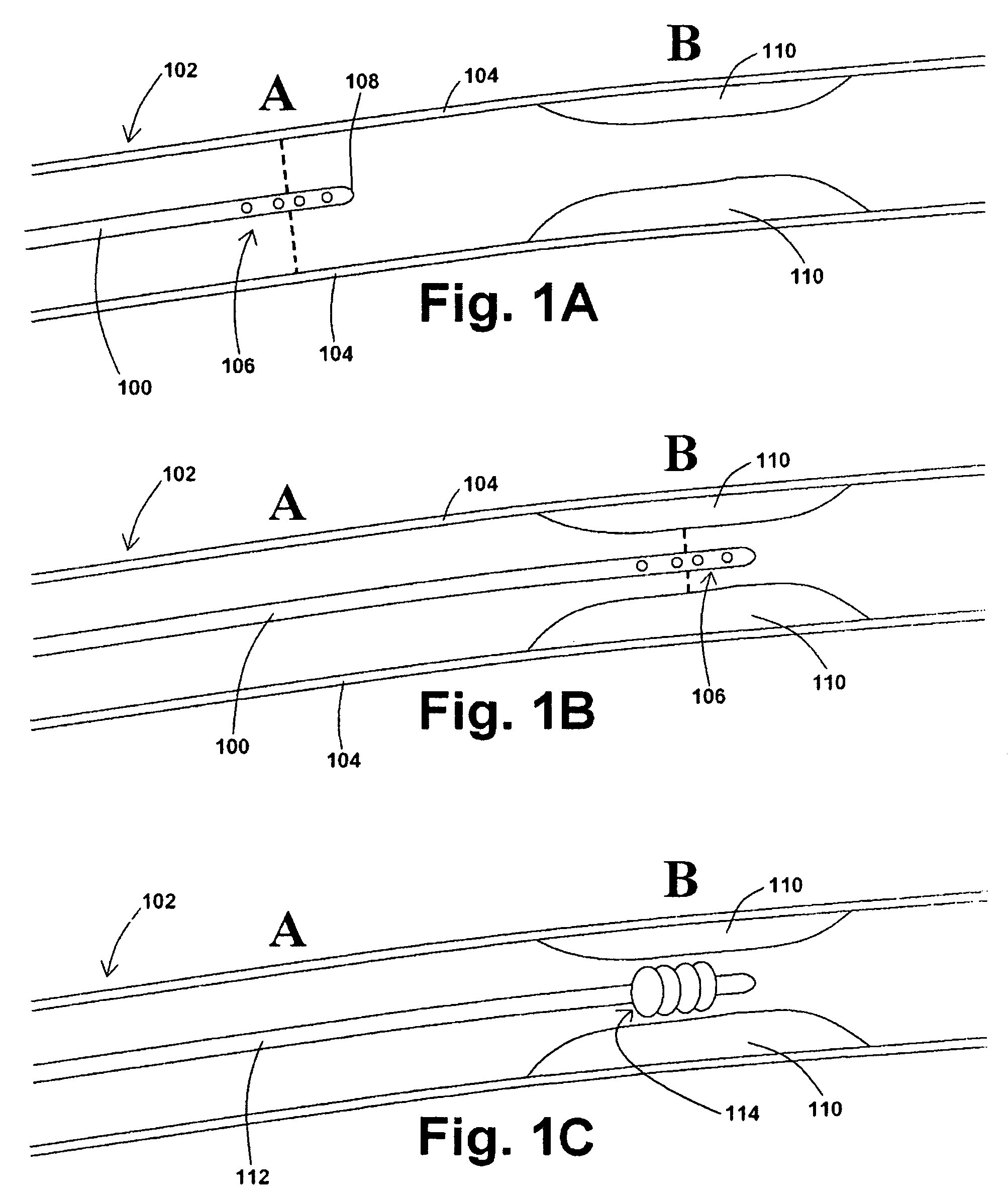 Devices, systems, and methods for removing stenotic lesions from vessels