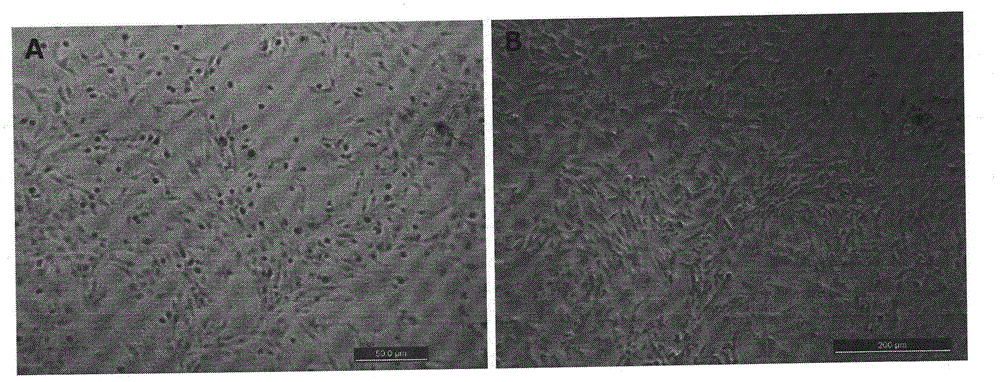 Method for preparing biological beautifying facial mask containing adipose derived stem cells and product thereof