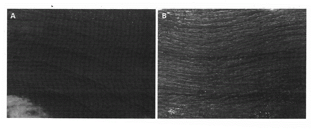 Method for preparing biological beautifying facial mask containing adipose derived stem cells and product thereof