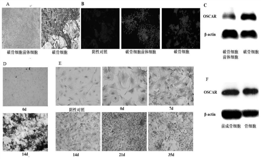 Bone remodeling regulating polypeptides and application