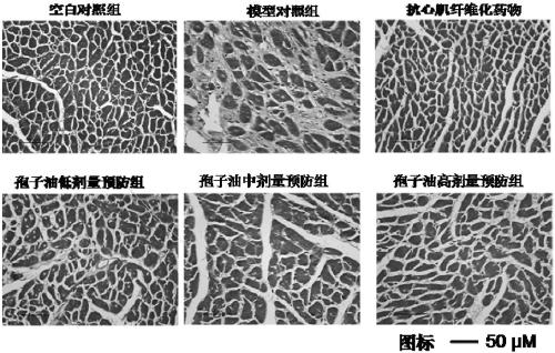 Ganoderma lucidum spore oil and novel application of pharmaceutical composition comprising ganoderma lucidum spore oil