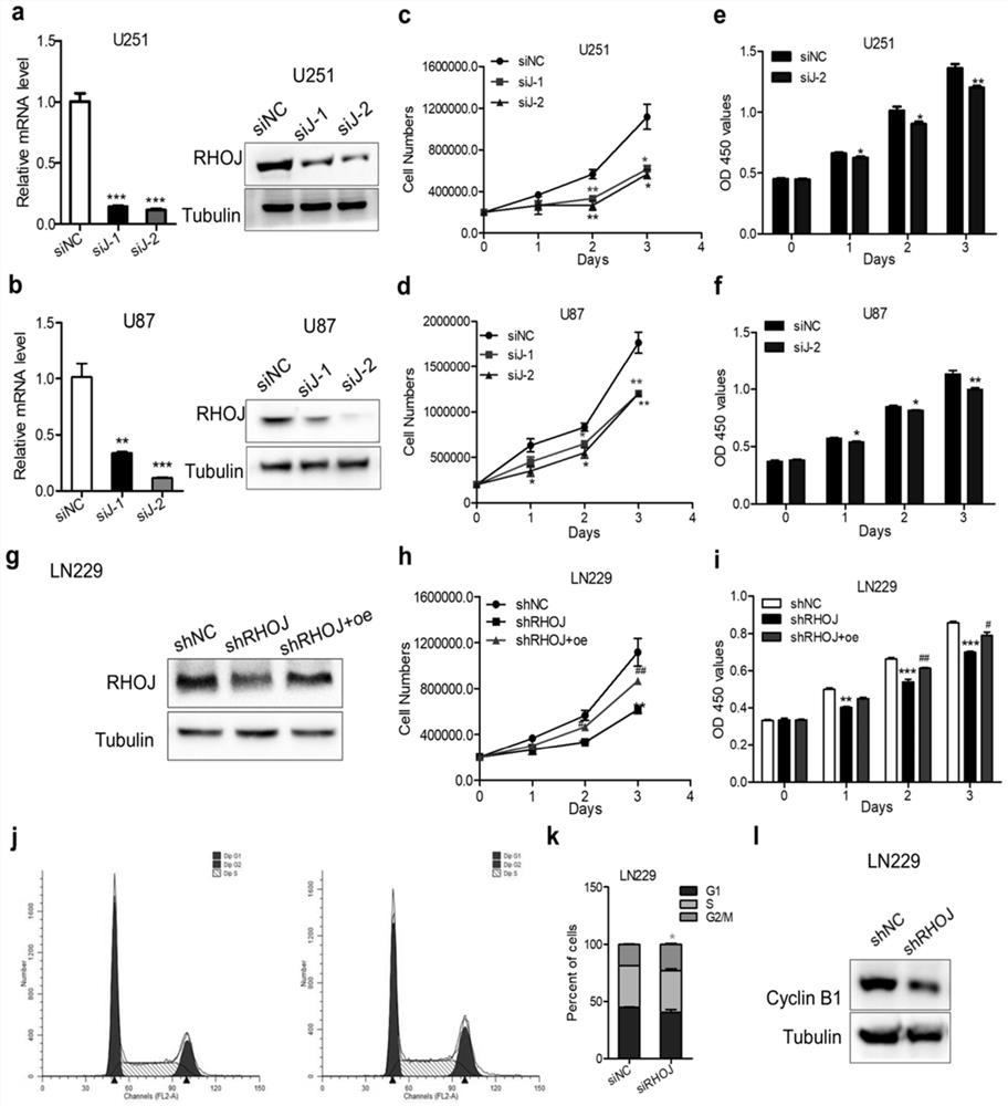 Application of malignant glioma biomarker