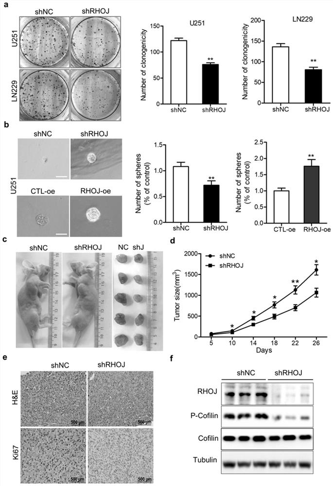 Application of malignant glioma biomarker