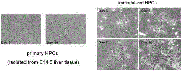 A reversible immortalized liver cell line carrying double suicide genes and its construction method