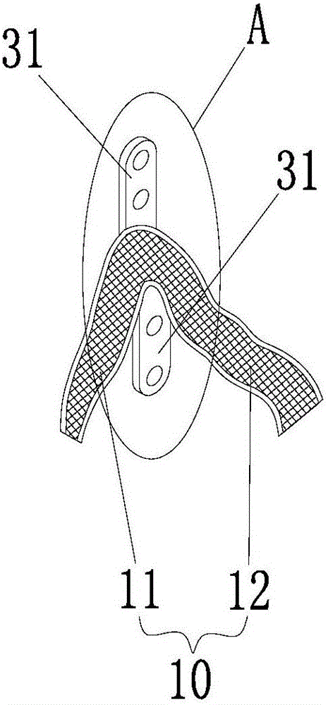 Fracture fixing structure and fracture fixing assembly with structure