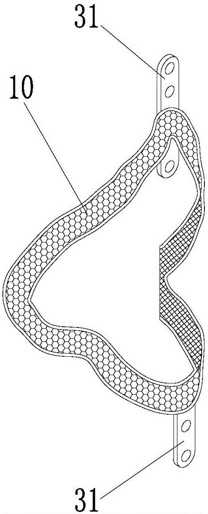 Fracture fixing structure and fracture fixing assembly with structure