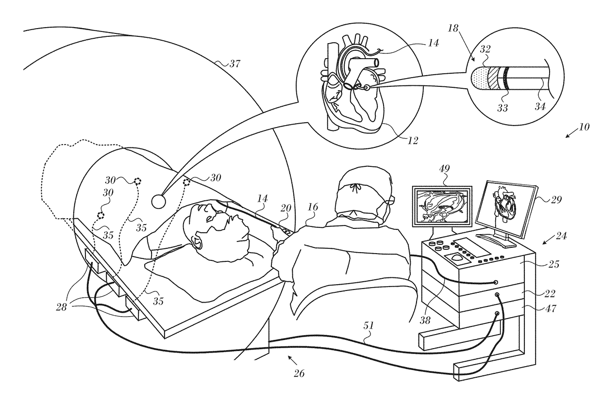 Magnetic resonance thermometry during ablation