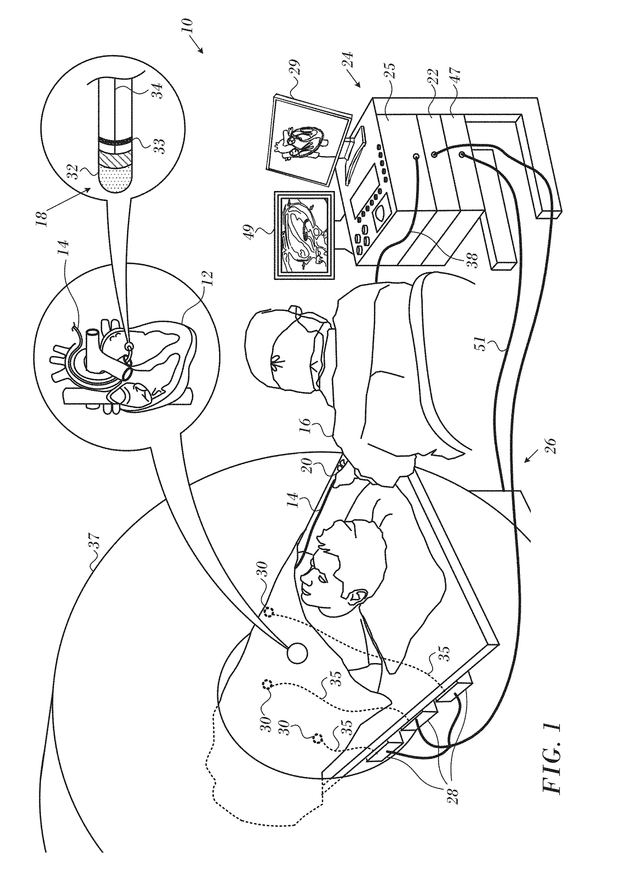 Magnetic resonance thermometry during ablation