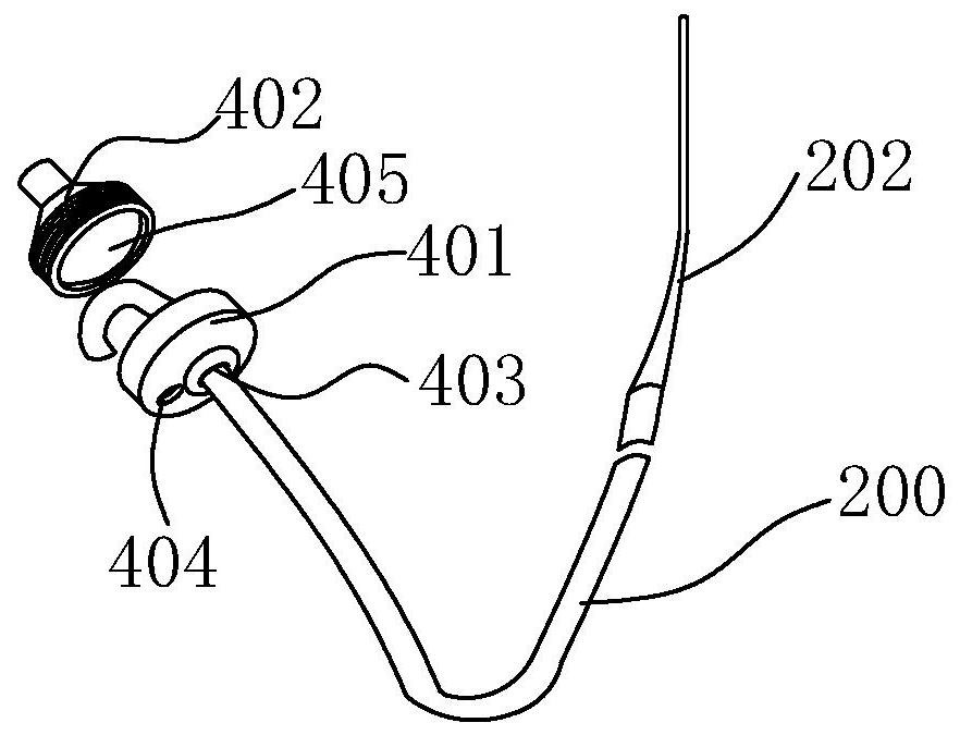 An esophageal local applicator for acute radiation esophagitis