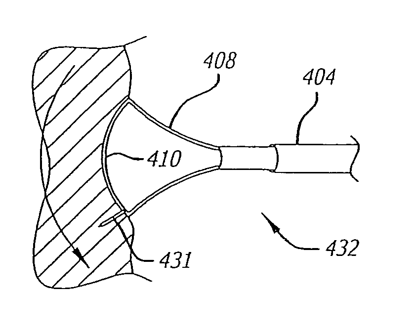 Electrical block positioning devices and methods of use therefor