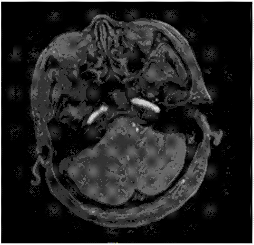 Medical image segmentation method and device