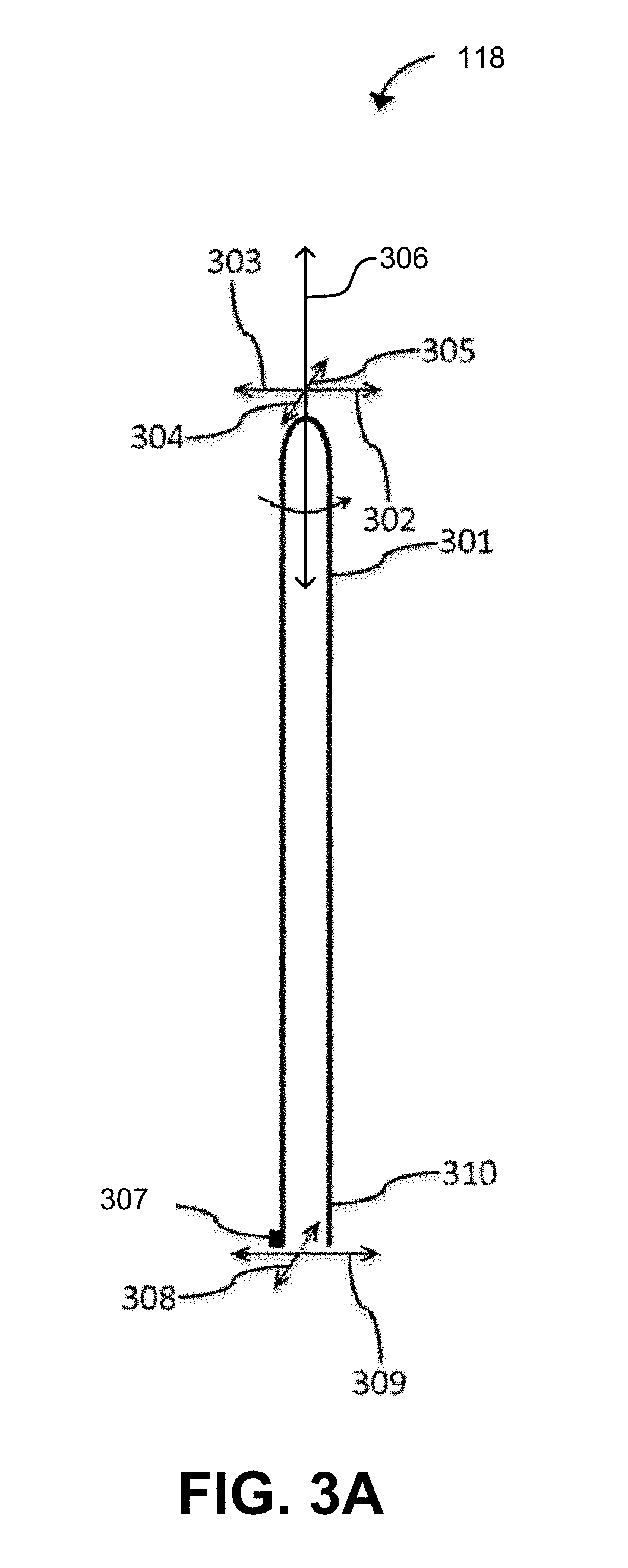 Object removal through a percutaneous suction tube