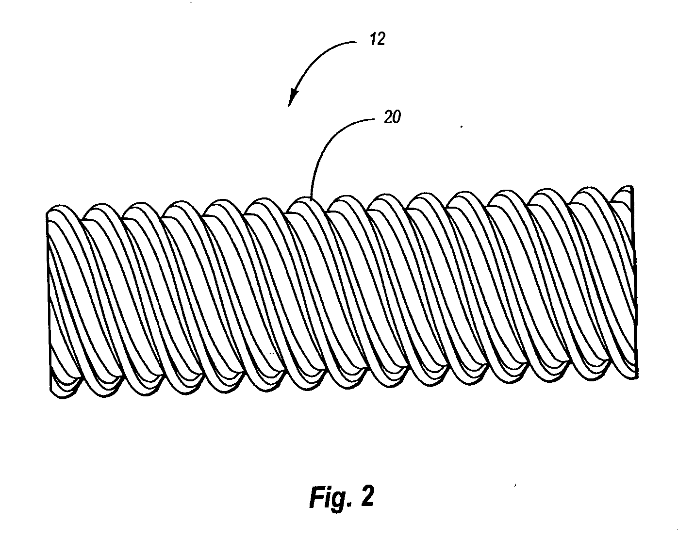 Potato sorting apparatus