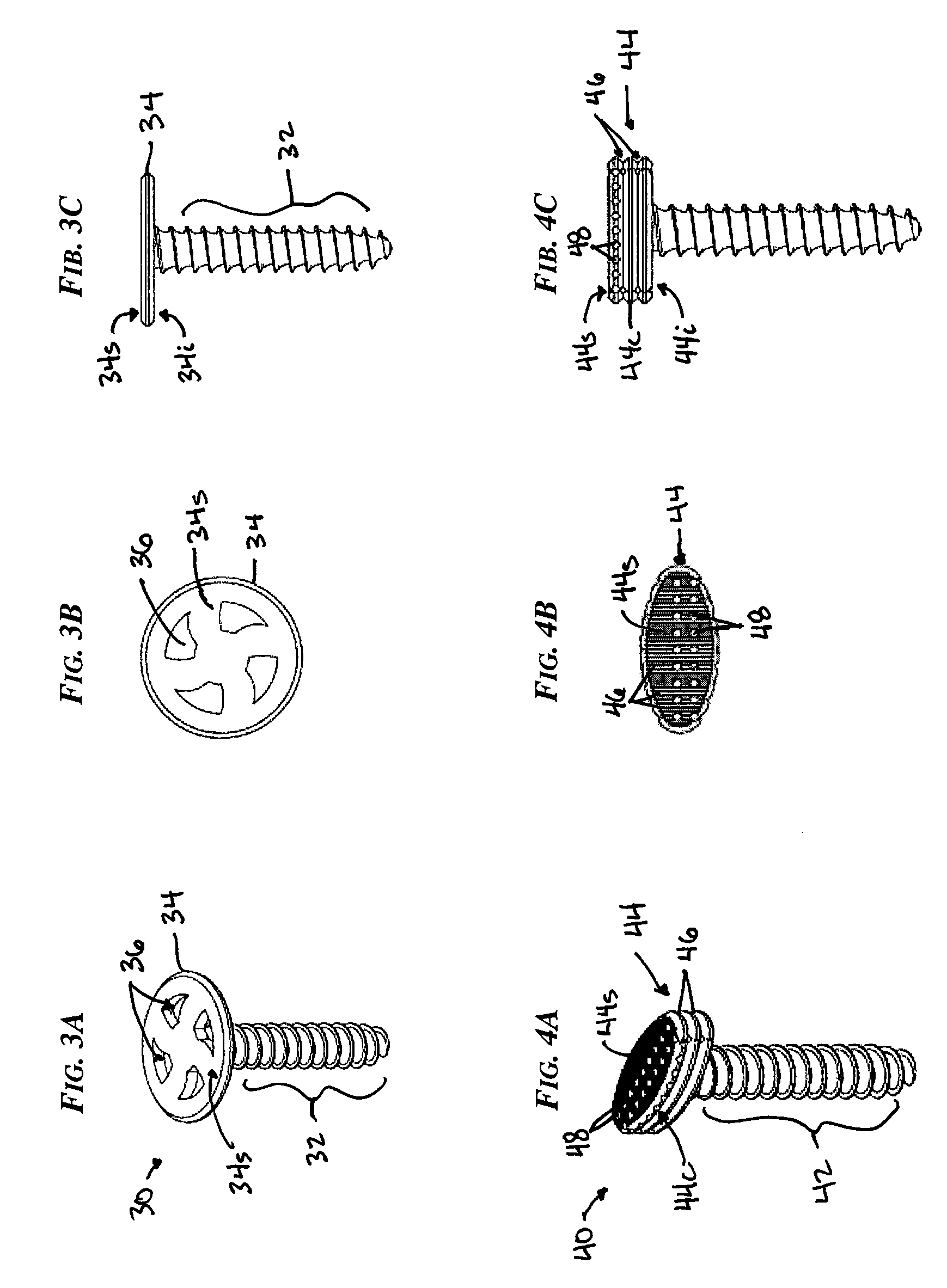 Insert for nucleus implant