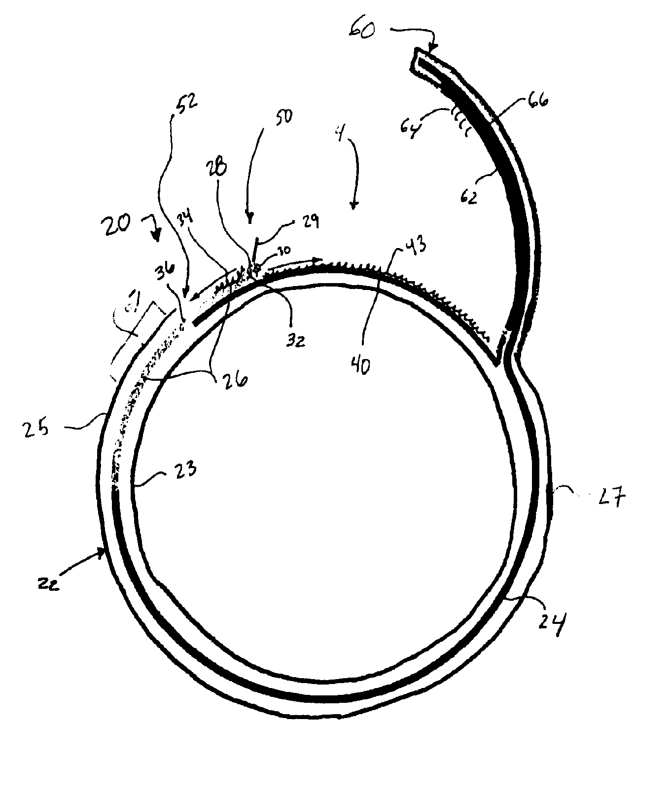 Adjustable Cuff System for Garments