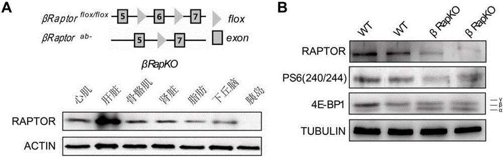 Mouse model for mTORC1 (mechanistic target of rapamycin 1) pathways and method for building mouse model