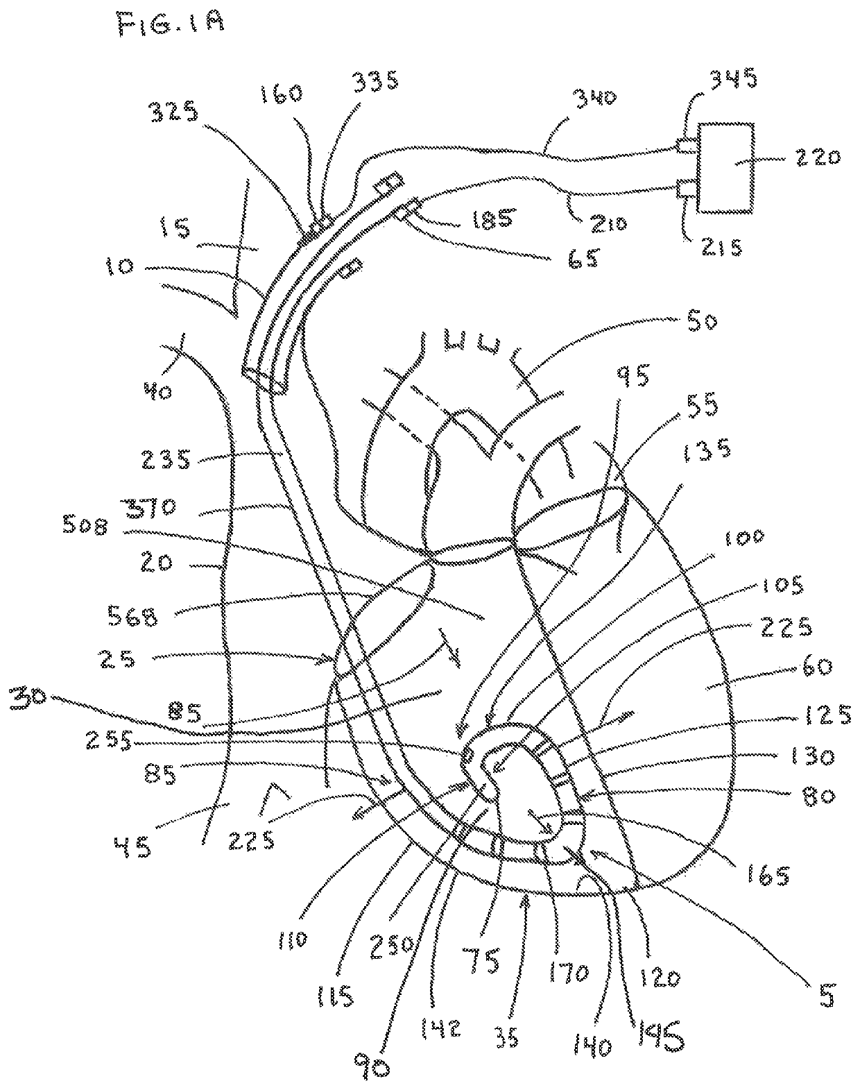 Temporary pacing lead