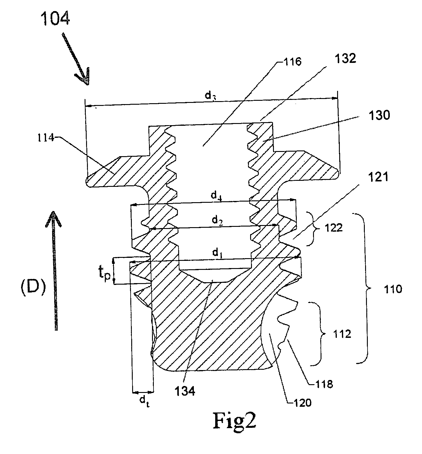 Hearing-aid anchoring element