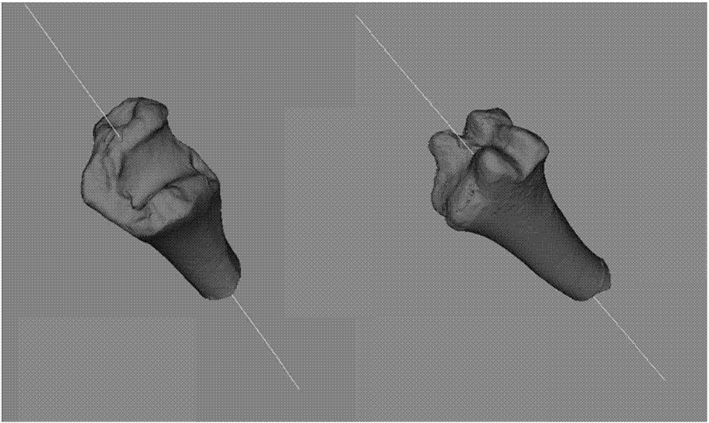 Broken bone section and broken bone model registration method based on maximum common subgraph and bounding box