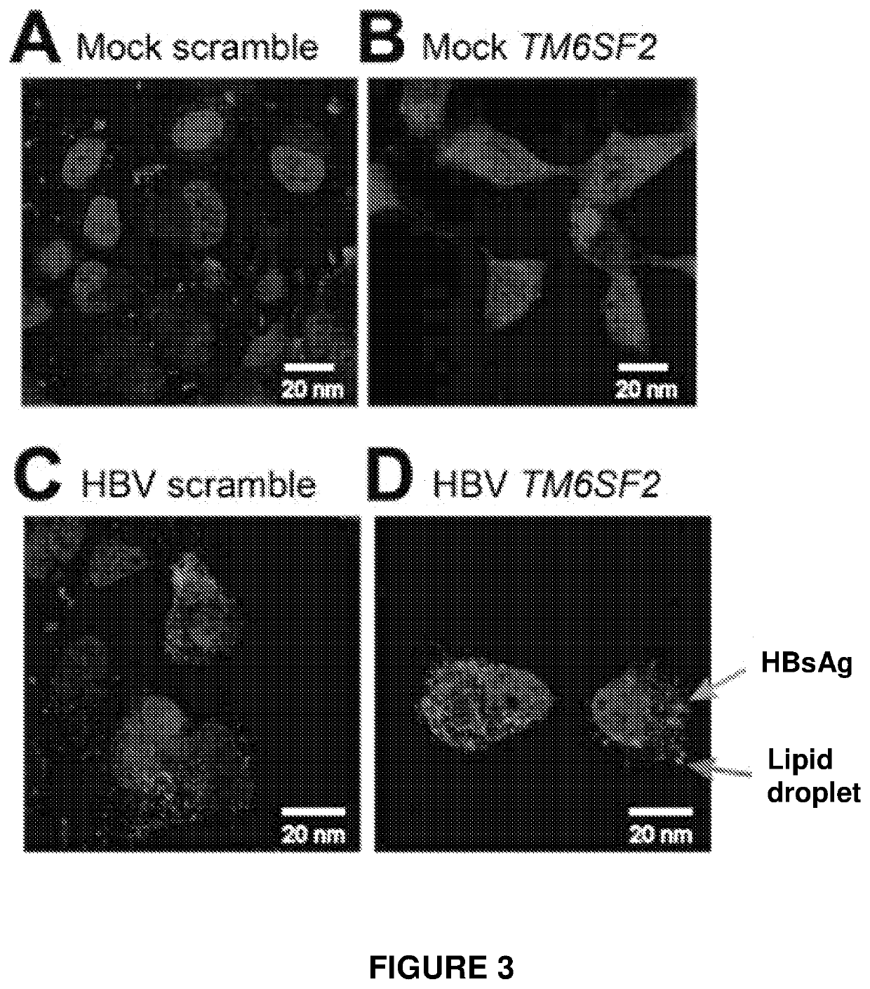 Compositions and methods for treating viral infections