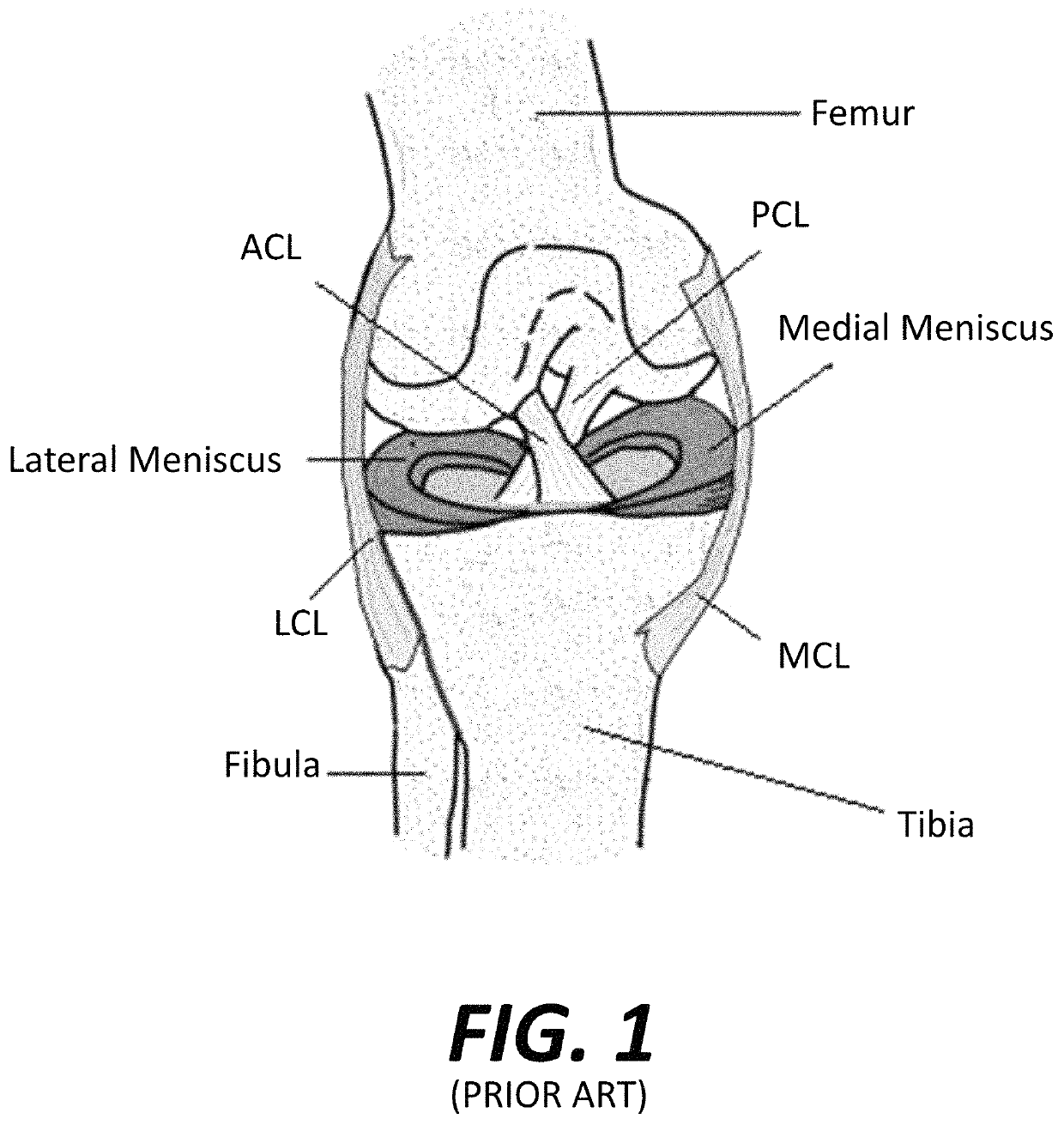 System and method for predicting tissue integrity