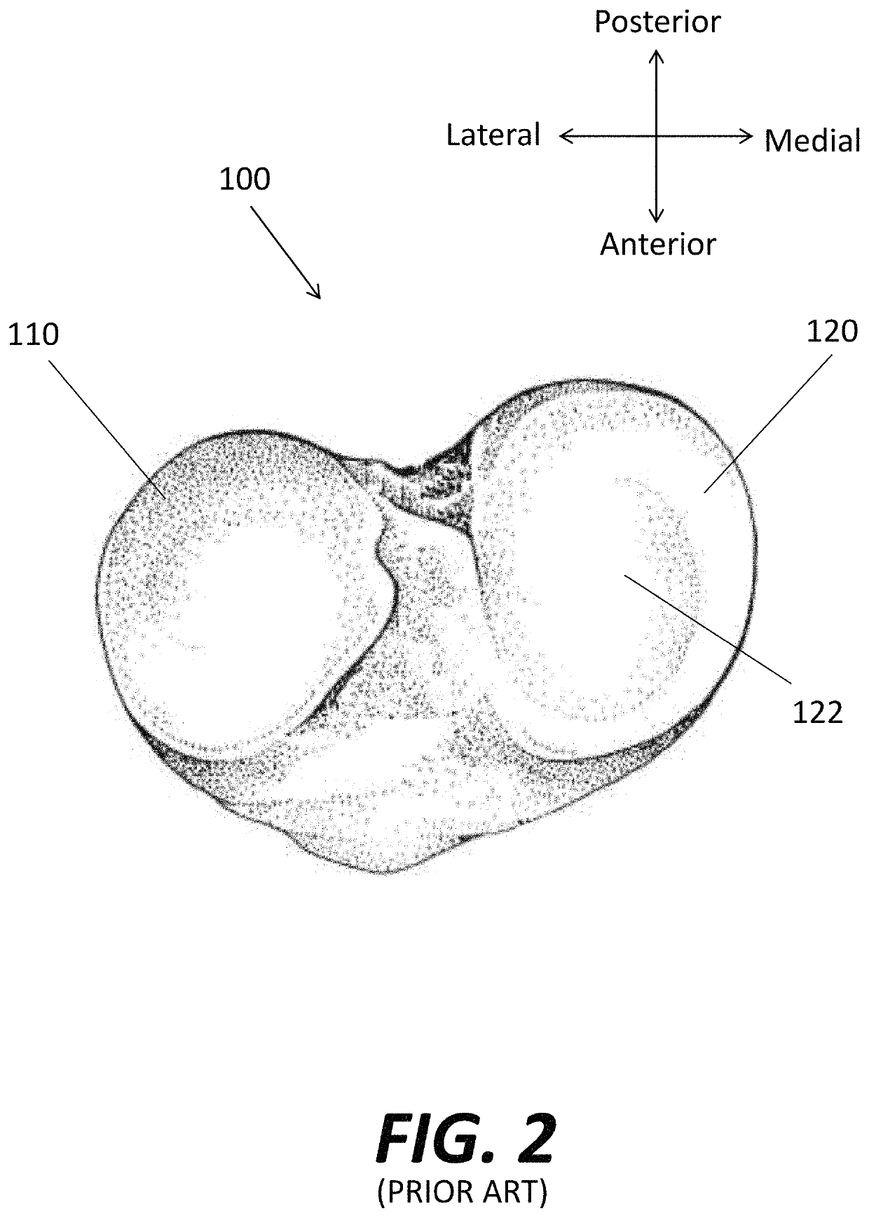 System and method for predicting tissue integrity