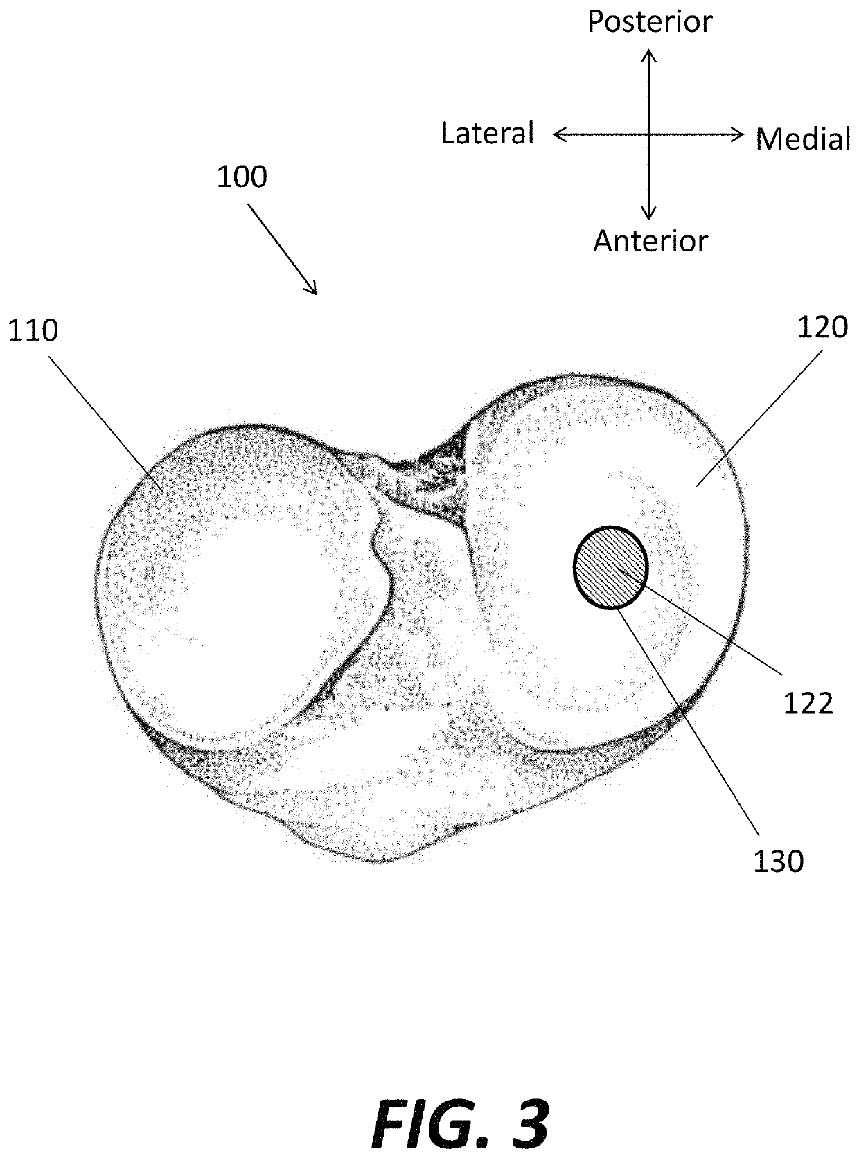 System and method for predicting tissue integrity