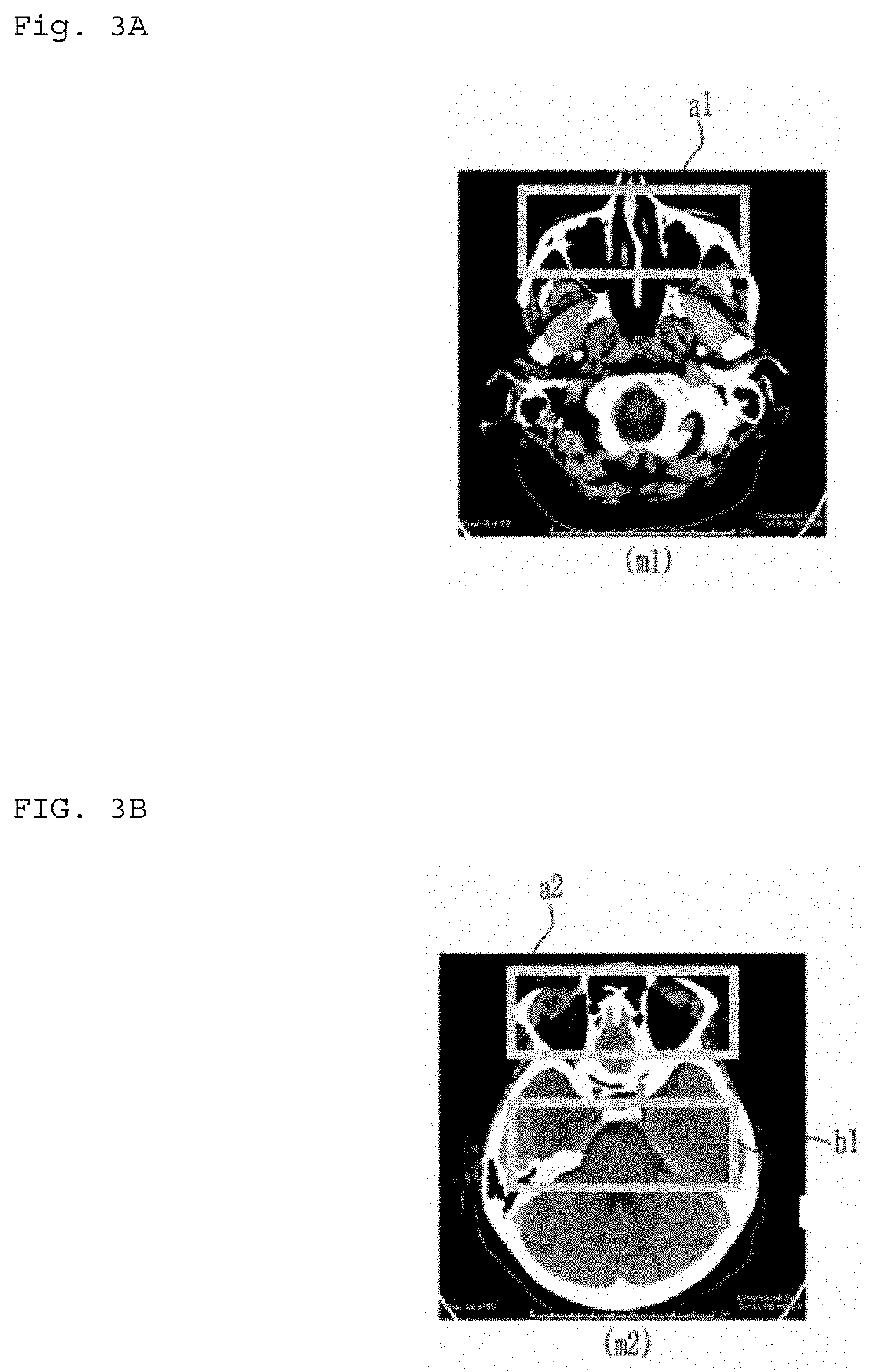 Diagnostic image converting apparatus, diagnostic image converting module generating apparatus, diagnostic image recording apparatus, diagnostic image converting method, diagnostic image converting module generating method, diagnostic image recording method, and computer recordable recording medium