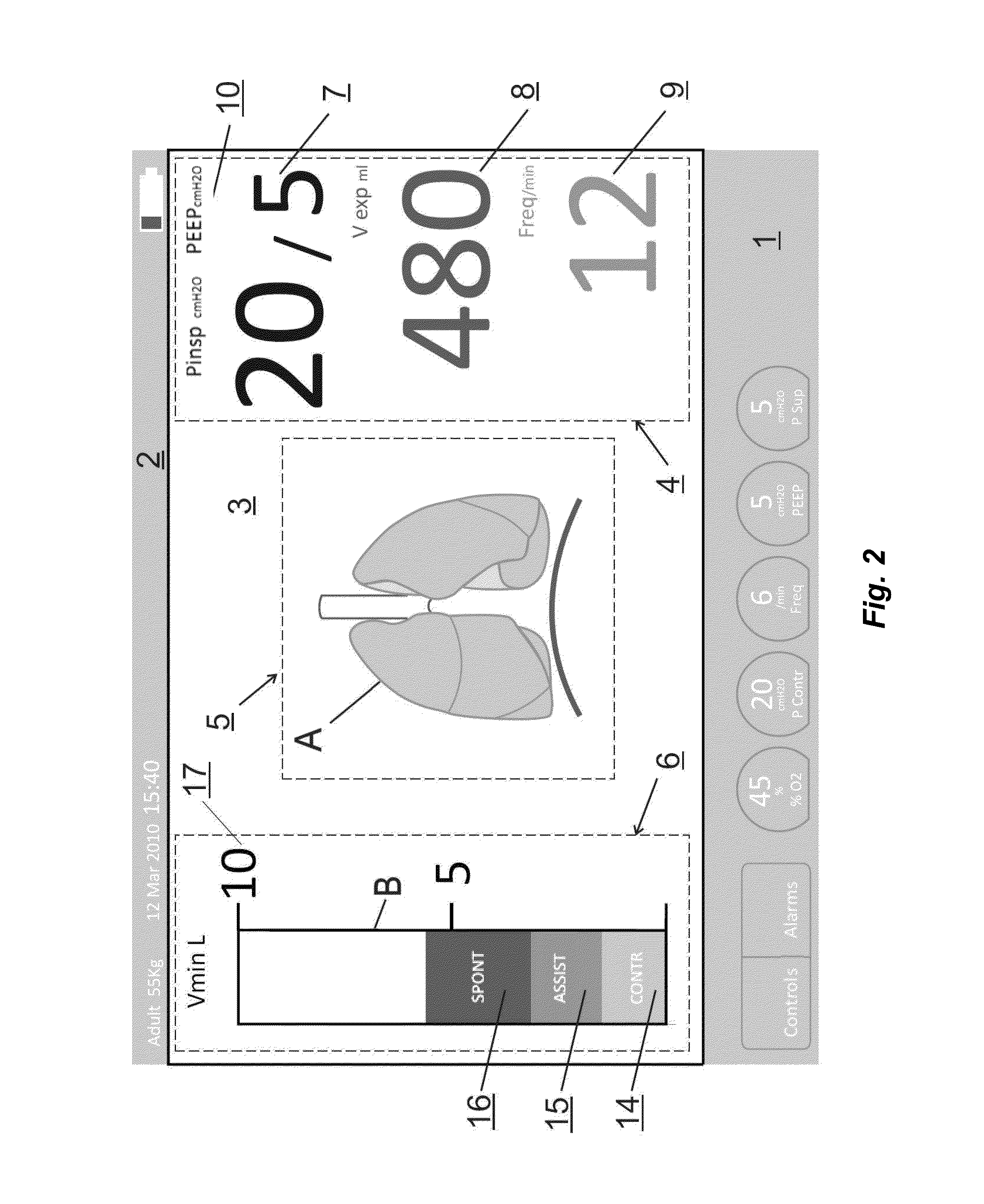 Lung ventilation device