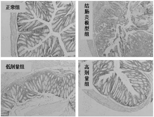 Lactobacillus rhamnosus with effect of relieving colitis and application of lactobacillus rhamnosus