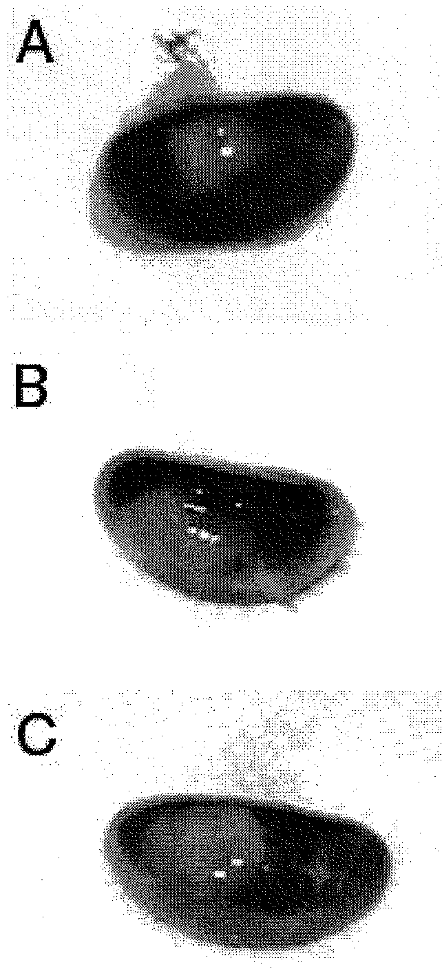 Compositions containing sertoli cells and myoid cells and use thereof in cellular transplants