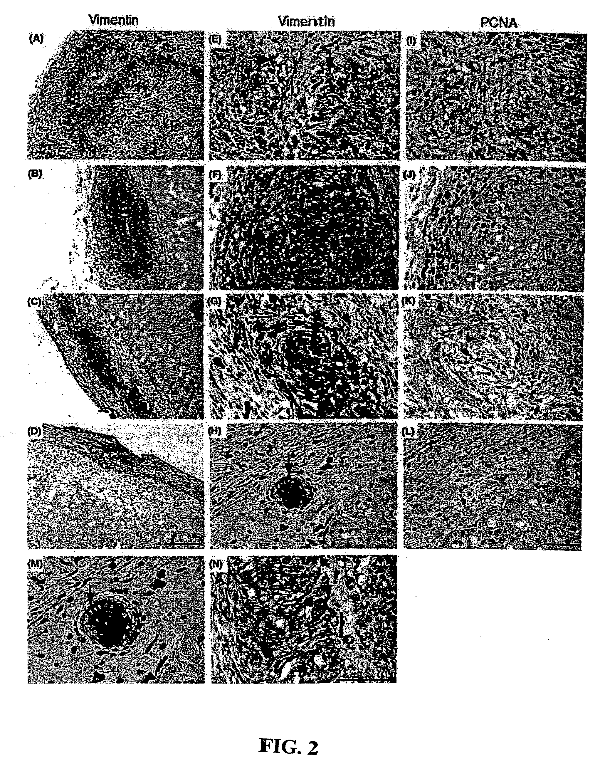 Compositions containing sertoli cells and myoid cells and use thereof in cellular transplants