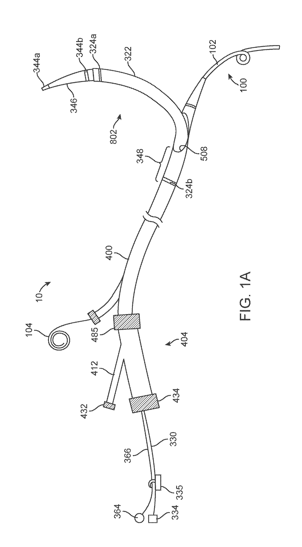 Anchoring delivery system and methods