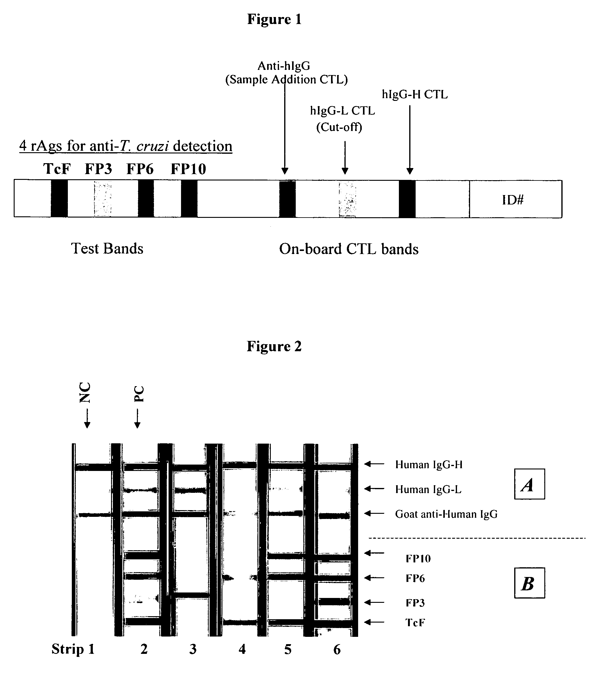 Methods for the detection and diagnosis of <i>Trypanosoma cruzi </i>infection