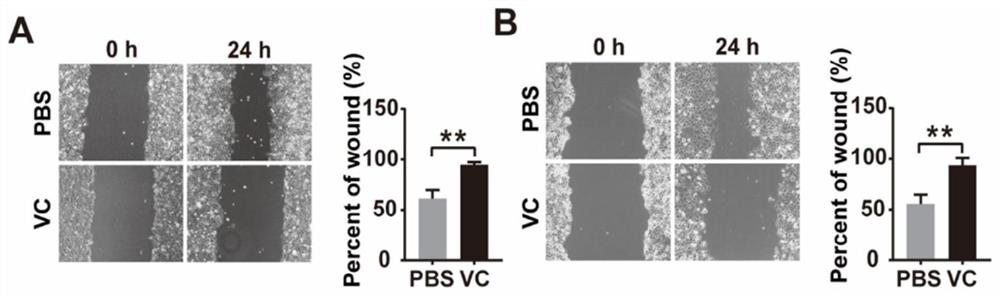 Application of phosphatase PHLPP2 in preparation of prognostic marker preparation for treating pancreatic cancer by vitamin C