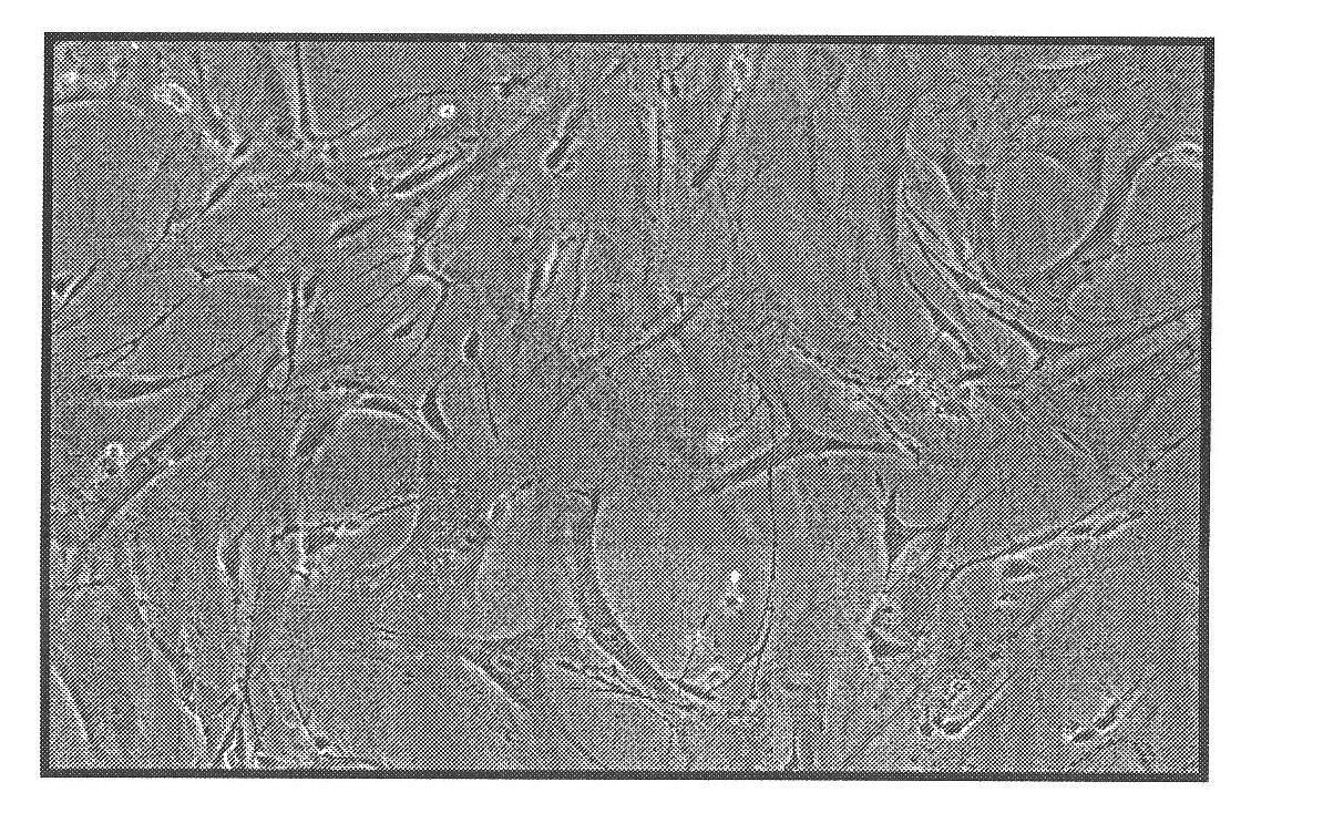 Human pulmonary artery smooth muscle cell separation and culturing method and application of same