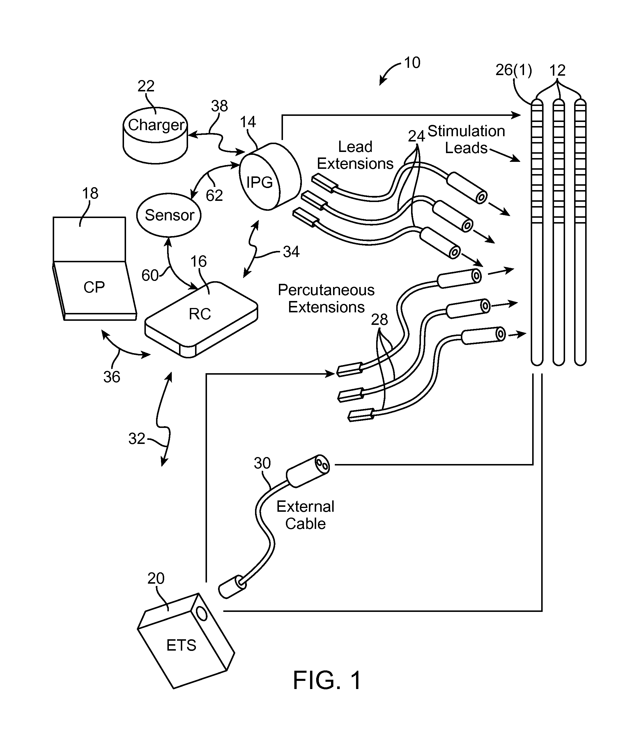 Method for treating hypertension via electrical stimulation of neural structures