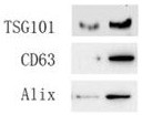 Stomach-targeted drug-loaded exosome and application thereof, and drug for treating stomach diseases