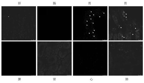 Stomach-targeted drug-loaded exosome and application thereof, and drug for treating stomach diseases