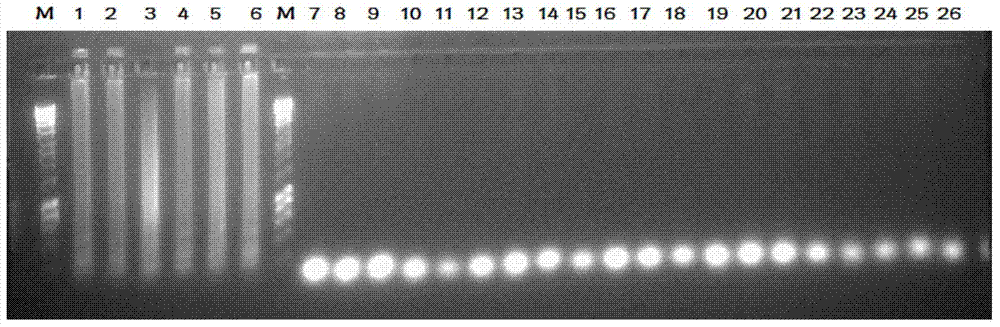 Histoplasma infection molecular diagnosis kit based on loop-mediated isothermal amplification (LAMP) technique principles and application thereof