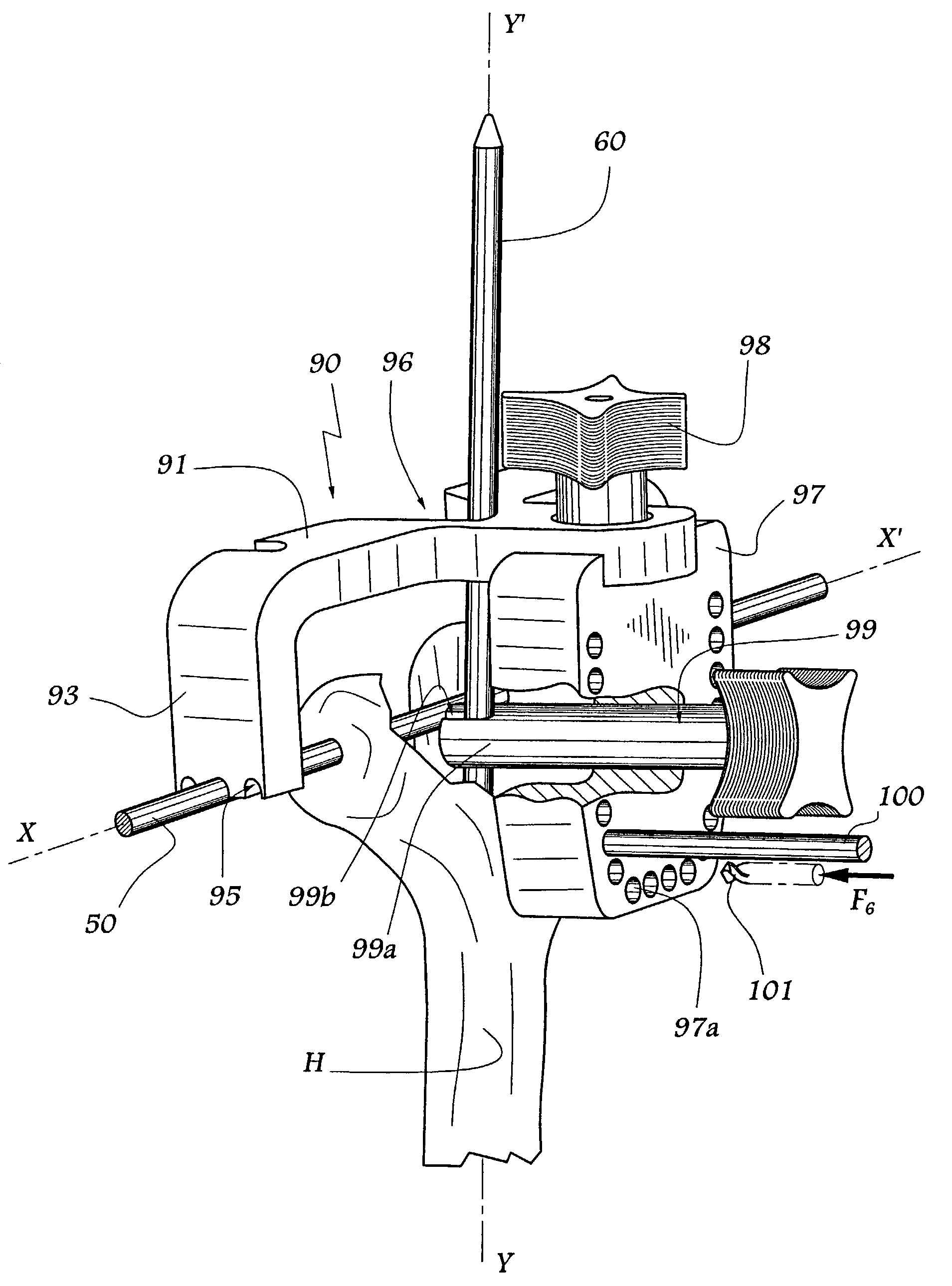 Ancillary tool for fitting a humeral component of an elbow prosthesis